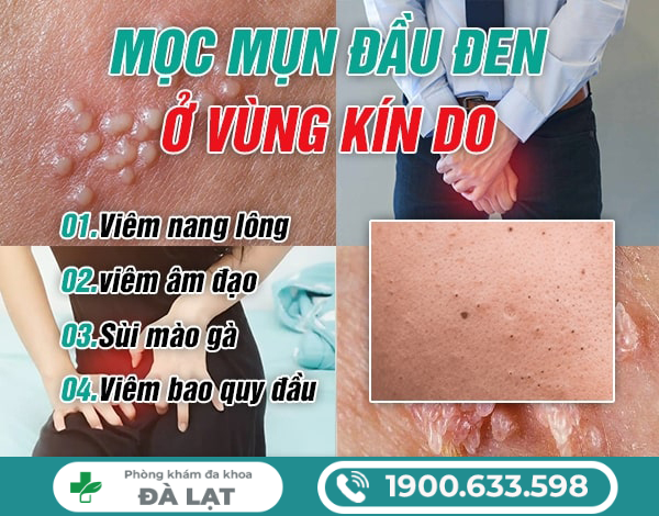 Hình ảnh minh họa